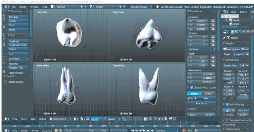 tooth-cad-model