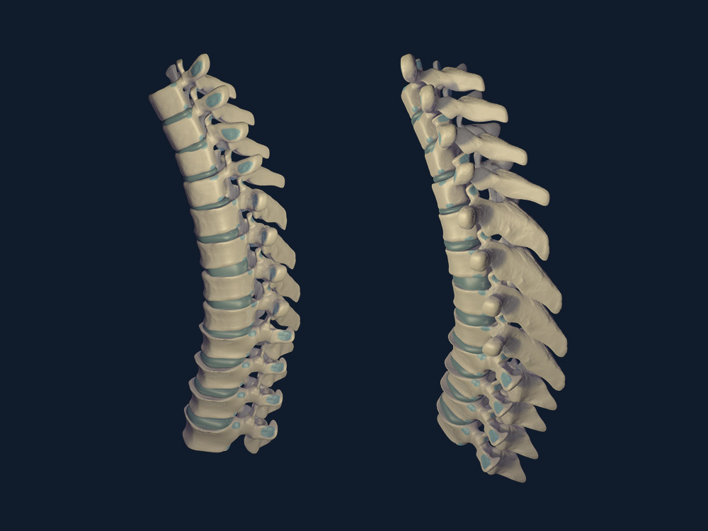 bones-cad-model