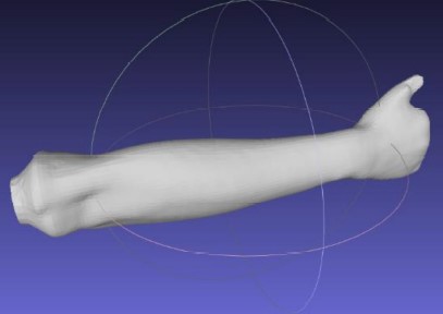 Hand-Orthoses-cad-model